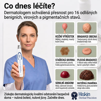 💛✅Oficiální značkový obchod | Hiskin® 7denní odstraňovač skvrn a pigmentových skvrn (Bezbolestný rollerball bez jizev)🐬（副本）