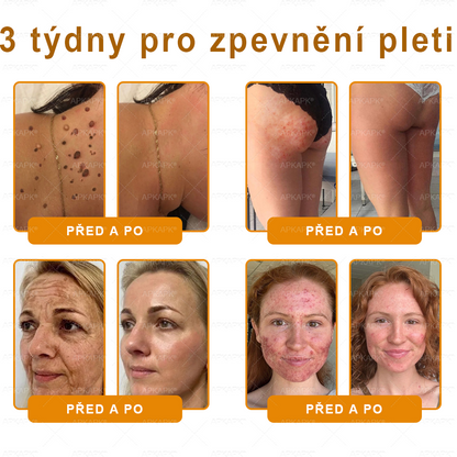 👑Zbývá pouze 5 krabic! ⭐Dodatečná sleva 50%! Pokud nyní zmeškáte, získáte ji až příští rok – 𝖠𝖯𝖪𝖠𝖯𝖪® medově jedový krém na obnovu pokožky