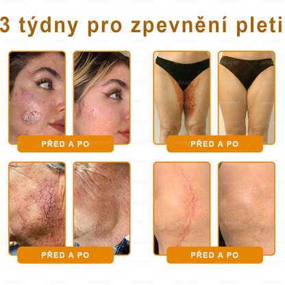👑Zbývá pouze 5 krabic! ⭐Dodatečná sleva 50%! Pokud nyní zmeškáte, získáte ji až příští rok – 𝖠𝖯𝖪𝖠𝖯𝖪® medově jedový krém na obnovu pokožky