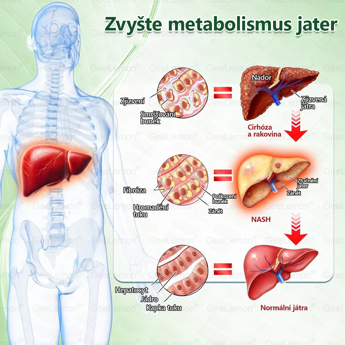 ✅ 𝐆𝐞𝑒𝑙𝑒𝐦𝐨𝐧® Glum𝐚𝐬𝐞tide 8 v 1 – Zeštíhlující nano mikrojihlový náplast 🇨🇿 Jen 1× denně ✅ Viditelné změny za 7 dní – na obezitu, kardiovaskulární zdraví, diabetes a kloubní problémy