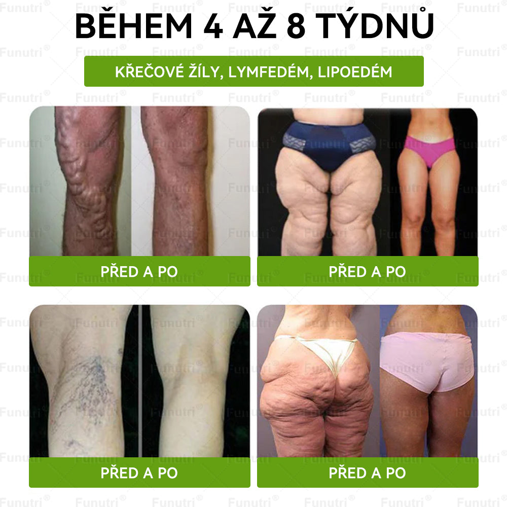 Oficiální obchod🧪 🔥Funutri® 10 v 1 metabolická tvarující náplast s nano mikrojehličkami (Pouze jednou denně, viditelné změny již za 7 dní)  Určeno pro osoby s obezitou, diabetem, spánkovou apnoe