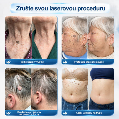 💛✅Oficiální značkový obchod | Hiskin® 7denní odstraňovač skvrn a pigmentových skvrn (Bezbolestný rollerball bez jizev)🐬（副本）