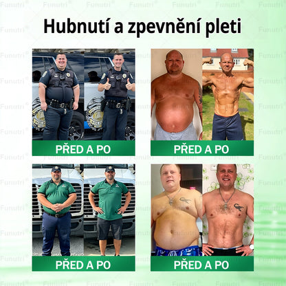 Oficiální obchod🧪 🔥Funutri® 10 v 1 metabolická tvarující náplast s nano mikrojehličkami (Pouze jednou denně, viditelné změny již za 7 dní)  Určeno pro osoby s obezitou, diabetem, spánkovou apnoe