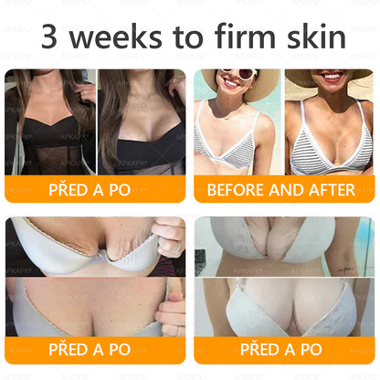 👑Zbývá pouze 5 krabic! ⭐Dodatečná sleva 50%! Pokud nyní zmeškáte, získáte ji až příští rok – 𝖠𝖯𝖪𝖠𝖯𝖪® medově jedový krém na obnovu pokožky