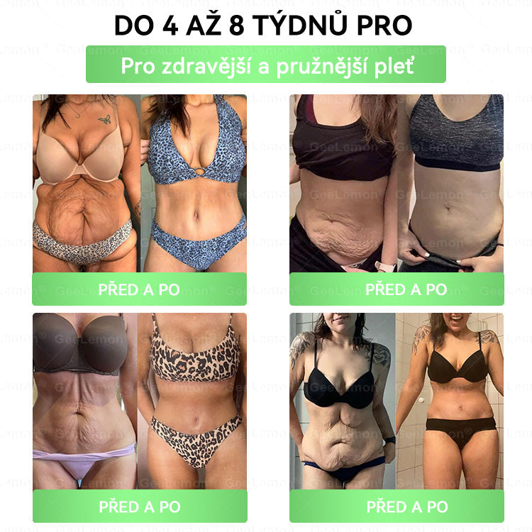 ✅ 𝐆𝐞𝑒𝑙𝑒𝐦𝐨𝐧® Glum𝐚𝐬𝐞tide 8 v 1 – Zeštíhlující nano mikrojihlový náplast 🇨🇿 Jen 1× denně ✅ Viditelné změny za 7 dní – na obezitu, kardiovaskulární zdraví, diabetes a kloubní problémy