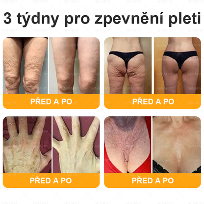 👑Zbývá pouze 5 krabic! ⭐Dodatečná sleva 50%! Pokud nyní zmeškáte, získáte ji až příští rok – 𝖠𝖯𝖪𝖠𝖯𝖪® medově jedový krém na obnovu pokožky
