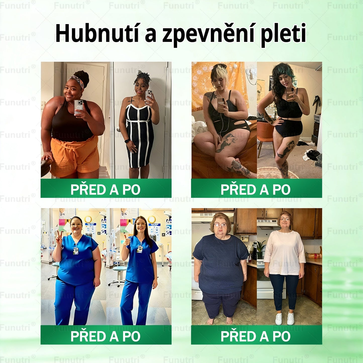 Oficiální obchod🧪 🔥Funutri® 10 v 1 metabolická tvarující náplast s nano mikrojehličkami (Pouze jednou denně, viditelné změny již za 7 dní)  Určeno pro osoby s obezitou, diabetem, spánkovou apnoe