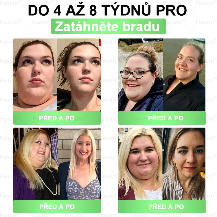 Oficiální obchod🧪 🔥Funutri® 10 v 1 metabolická tvarující náplast s nano mikrojehličkami (Pouze jednou denně, viditelné změny již za 7 dní)  Určeno pro osoby s obezitou, diabetem, spánkovou apnoe