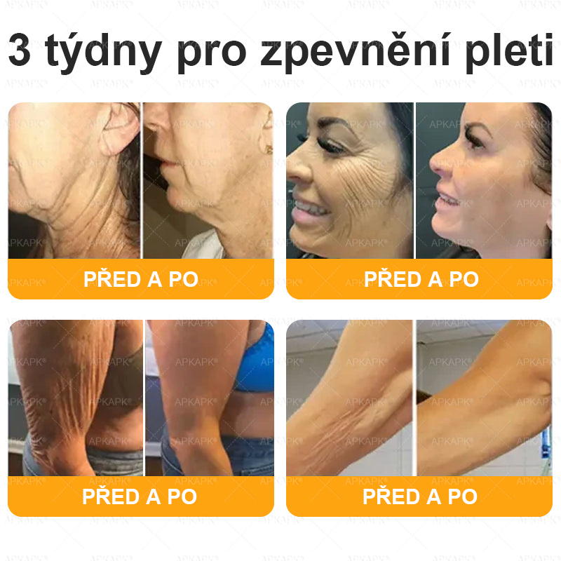 👑Zbývá pouze 5 krabic! ⭐Dodatečná sleva 50%! Pokud nyní zmeškáte, získáte ji až příští rok – 𝖠𝖯𝖪𝖠𝖯𝖪® medově jedový krém na obnovu pokožky