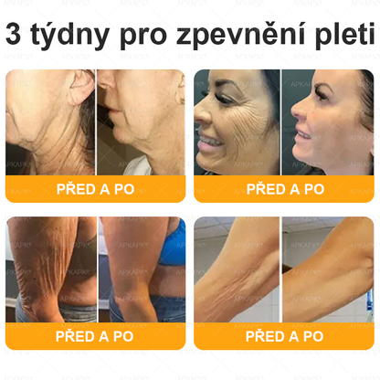 👑Zbývá pouze 5 krabic! ⭐Dodatečná sleva 50%! Pokud nyní zmeškáte, získáte ji až příští rok – 𝖠𝖯𝖪𝖠𝖯𝖪® medově jedový krém na obnovu pokožky