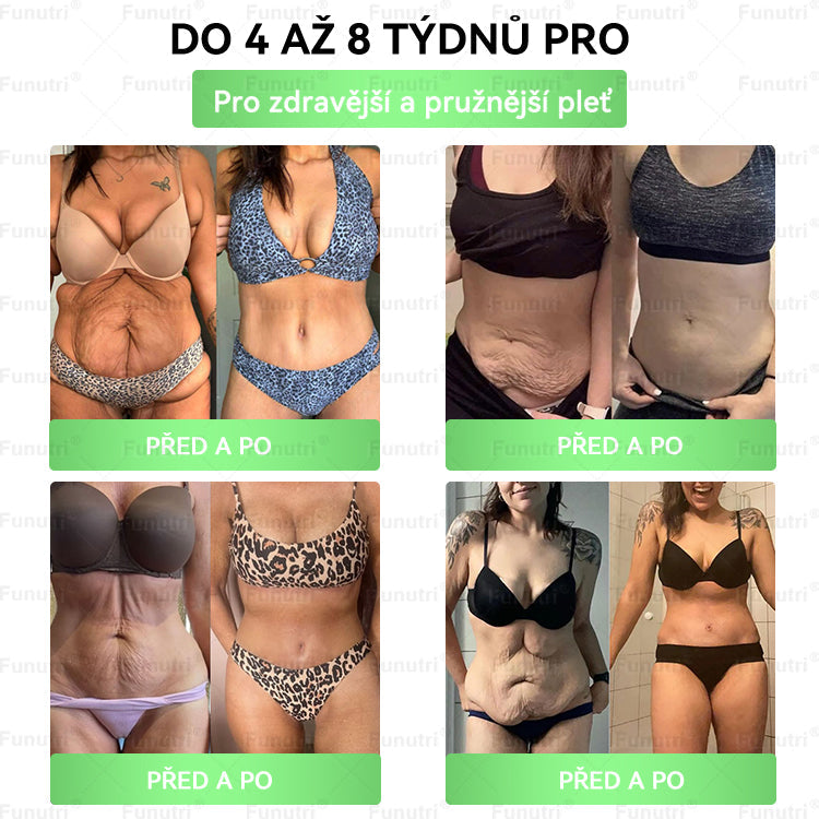 Oficiální obchod🧪 🔥Funutri® 10 v 1 metabolická tvarující náplast s nano mikrojehličkami (Pouze jednou denně, viditelné změny již za 7 dní)  Určeno pro osoby s obezitou, diabetem, spánkovou apnoe