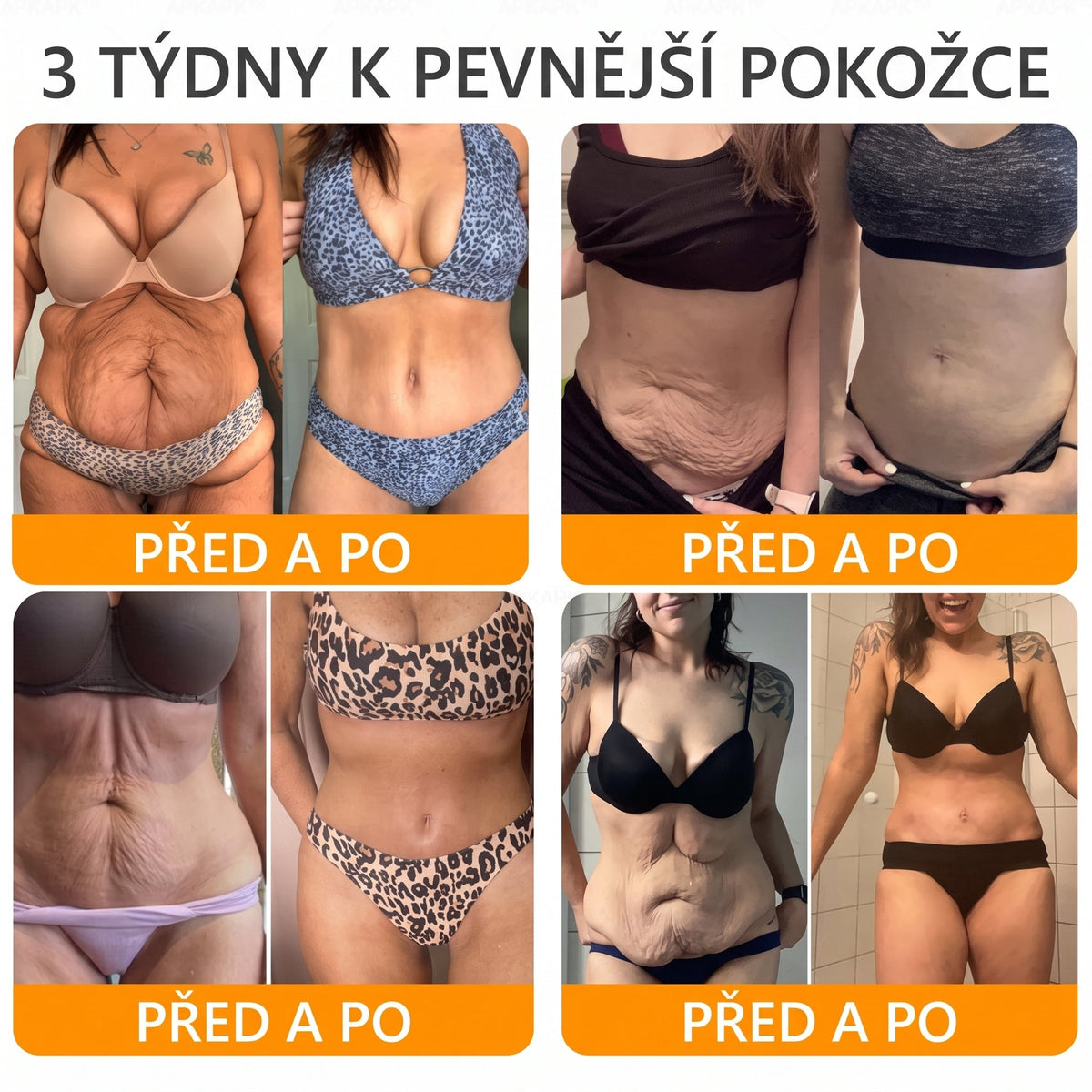 👑Zbývá pouze 5 krabic! ⭐Dodatečná sleva 50%! Pokud nyní zmeškáte, získáte ji až příští rok – 𝖠𝖯𝖪𝖠𝖯𝖪® medově jedový krém na obnovu pokožky
